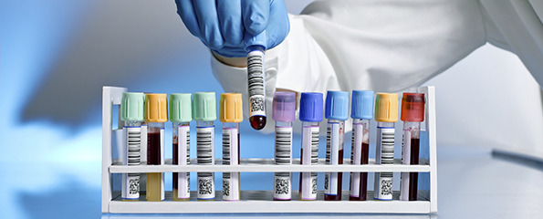 Origon Diagnostic Home Visit Sample Orion Diagnostic PathLab